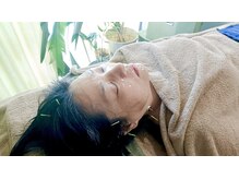 PUNAYU【鍼灸 | アーユルヴェーダ】/美容鍼灸×炭酸パック