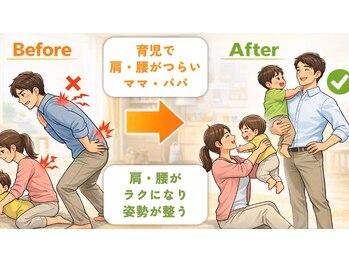 ローリエ/育児で肩こりがつらいあなたへ