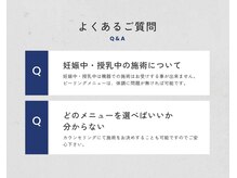 シェーン(Schon)/よくあるご質問