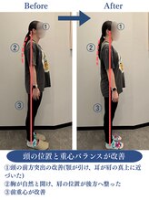 リボディサポート(Re:Body Support)/体験レッスンでの変化(20代女性)