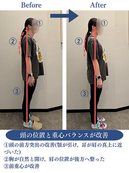 リボディサポート(Re:Body Support)/体験レッスンでの変化(20代女性)