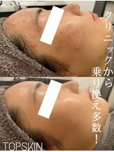 トップスキン 名駅(TOPSKIN) 一生モノの 肌を創る