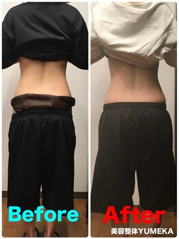 美容整体ユメカ(美容整体YUMEKA)/骨盤ダイエット+骨盤ストレッチ