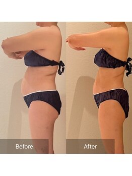 ルナスーリヤ 仙台店/セルドライブプロ☆お腹/背中