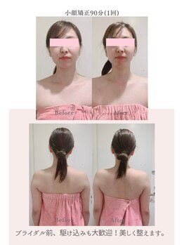 トゥインクル 麻布(twinkle)/麻布十番/シンメトリー小顔矯正