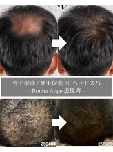 ボニータアンジュ 恵比寿(Bonita Ange)&nbsp;育毛促進 AOI