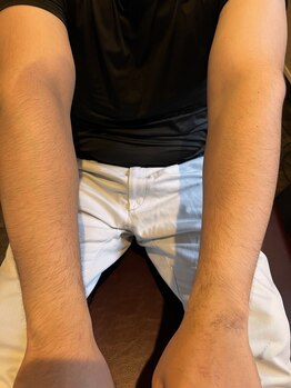 ディオラビューティーサロン(Diora)/田川脱毛/飯塚/眉毛/まゆげ/