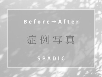 スペイディック(SPADIC)/