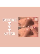クリアラボ 豊中(Clear Lab)/Before&After