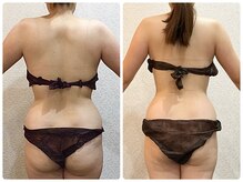 ウェリナ平和堂長久手院/小顔矯正/骨盤矯正/痩身/整体