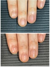 ルカロンネイル(Rukaron Nail)/埋もれてる爪
