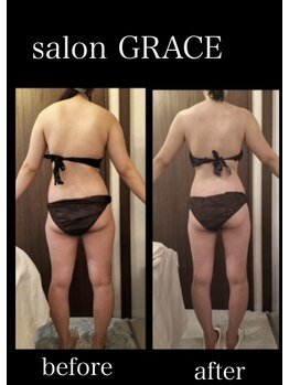 サロン グレイス(salon GRACE)/