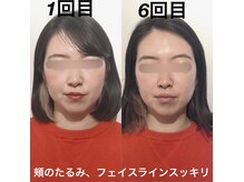 経堂鍼灸整体院