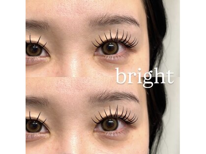 ブライト(bright)の写真
