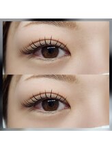 イーネ(e_ne)/フラット付け放題