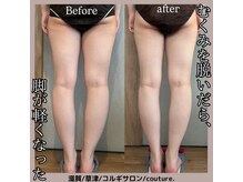 クチュール(couture.)/4回目after