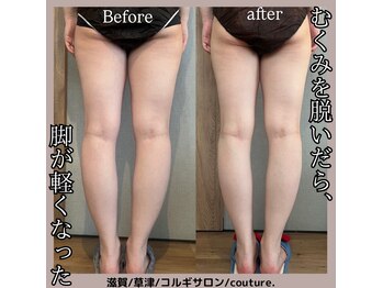 クチュール(couture.)/4回目after