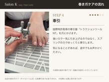 サロン ケー(Salon K)/巻き爪ケアの流れ4　牽引