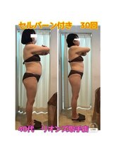 リオンズ 茨城ミスターマックス取手店/セルバーン付き　30回　40代女性