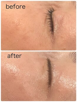 ハッチー(Hacchi)/陶肌トリートメント！