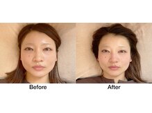 こじま 富雄団地接骨院/フェイスラインがすっきり♪