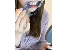 エクシアホワイトニング 碧南