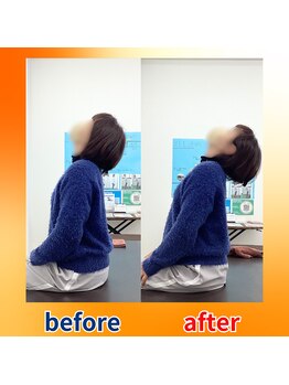 ストレッチヒーロー 福山神辺店/ビフォーアフター【1回の変化】