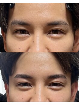 アルデオンワン(ARDEON.1)/【メンズ眉毛】Before/after