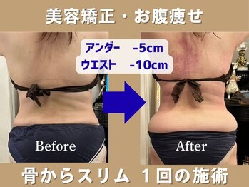 星ヶ丘整体NOA/理想骨格★骨からスリム