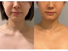 アンフィルミエール 若葉本店(infirmiere)