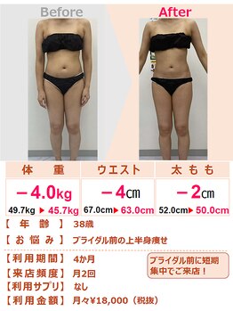 スリムステーション 川西市(Slim Station)/ブライダル前のご利用実績