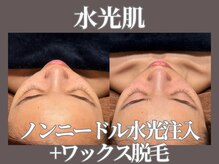 マヴィ 守口店(MavY.)/ノンニードル水光注入