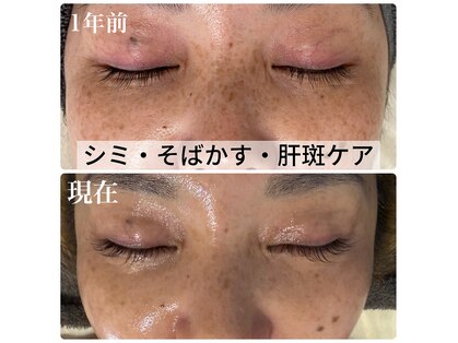 サロンドエテ(salon de ete)の写真