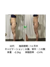 リシャイン(Reshine)/ビフォーアフター