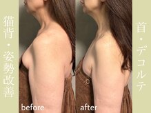 健志接骨院/πテラピー姿勢改善