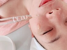 エステサロン ラ マーノ(La mano)/ポレーション導入でお肌イキイキ