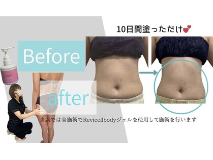 シャルム(Charme)の写真