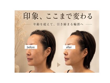 ポノティー(PONOTY)の写真