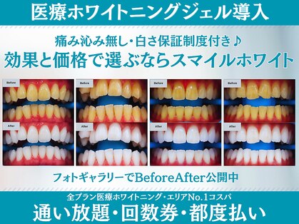 スマイルホワイト 練馬店の写真