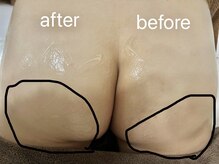 エムローズ(M.rose)/究極の美尻ケア