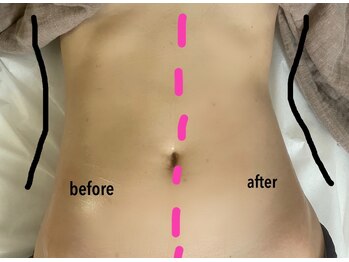 ラグナブルー(Laguna blue)/美腸リンパはここまで変わる