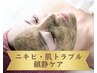【話題の肌管理】繰り返すニキビケア・毛穴のお悩みを垢抜け陶器美肌へ★