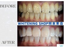 ホワイトニングショップ熊本東店/