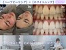 【ハーブピーリング×ホワイトニング】ホットペッパー限定55,050円→40,000円