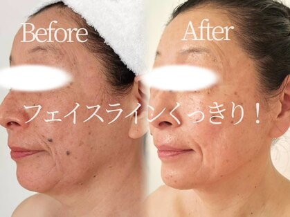 アモントベールの写真