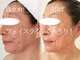アモントベールの写真