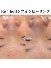 サラ/シフォンピーリング