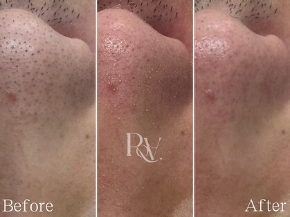 ロア(RoA.)の写真