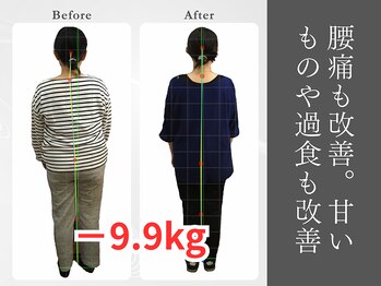 県庁通り整体院/腰痛改善。甘いものもおさまった