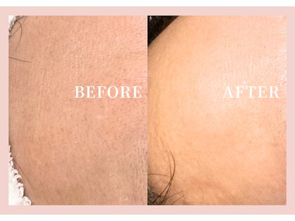 ハナハナ(hanahana)の写真